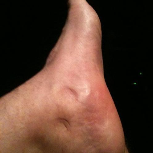 Carlos Morales_Ankle And Food_Indentations
